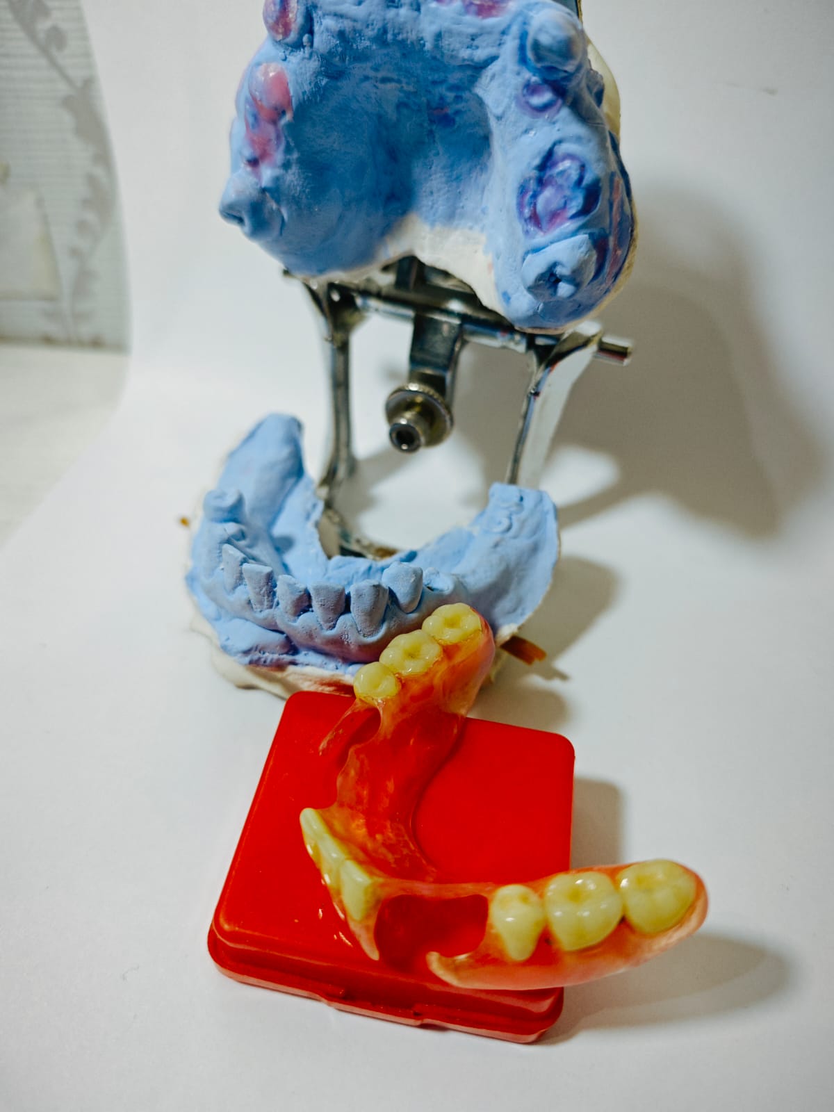 Model cetakan gigi palsu Valplast Viqrie Dental Bogor 1