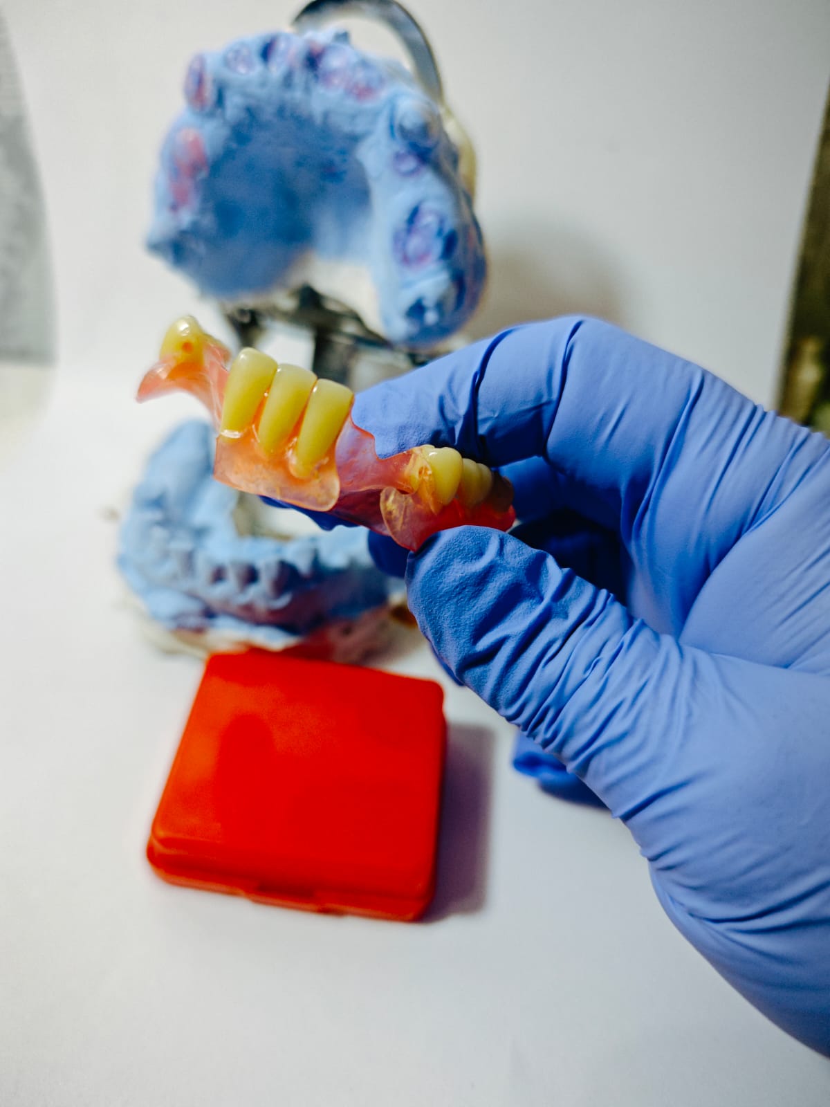 Model cetakan gigi palsu Valplast Viqrie Dental Bogor 2