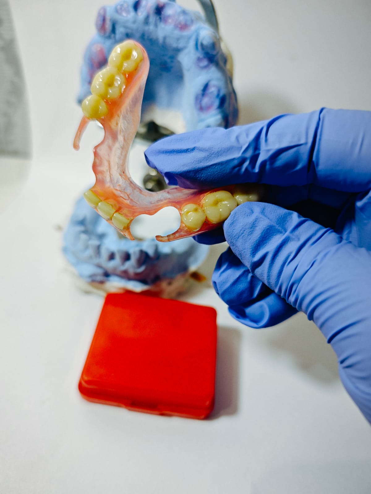 Model cetakan gigi palsu Valplast Viqrie Dental Bogor 3