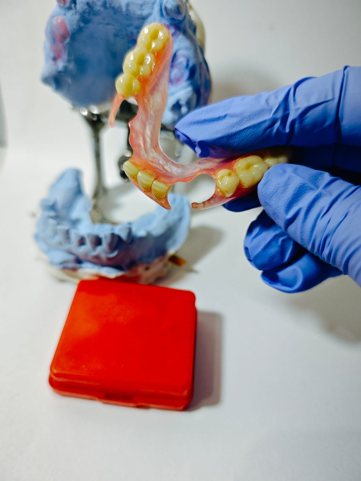 Model cetakan gigi palsu Valplast Viqrie Dental Bogor 4