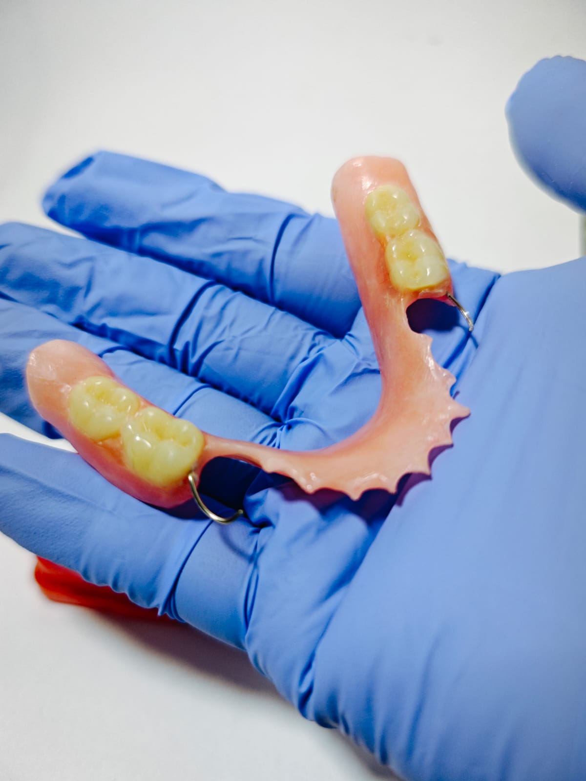Pembuatan gigi palsu akrilik Viqrie Dental Bogor