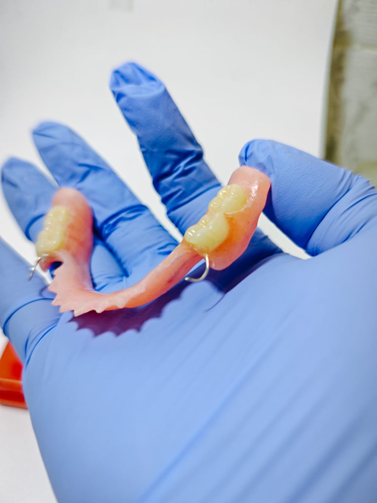 Hasil gigi palsu akrilik Viqrie Dental foto 4