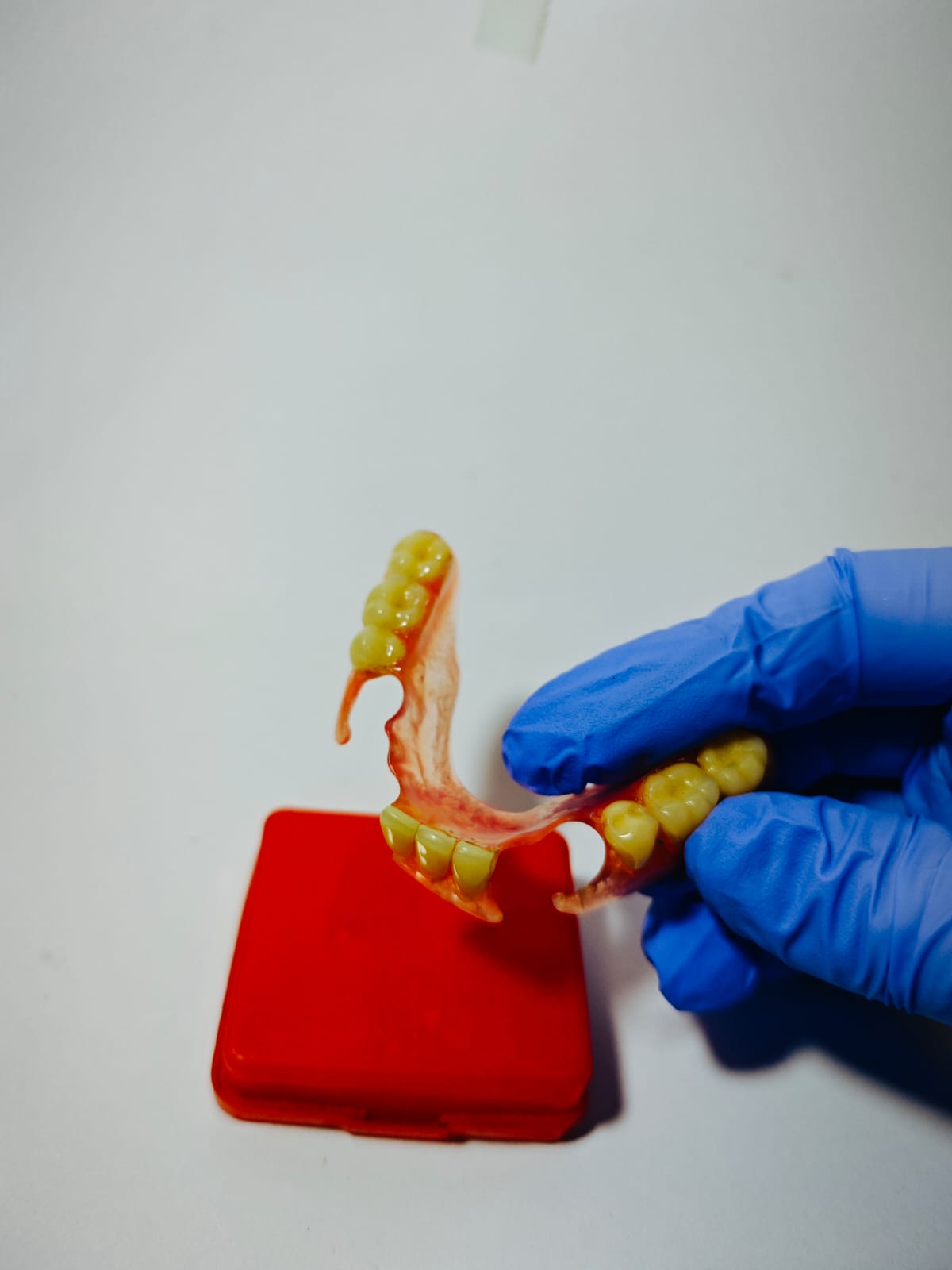 Gigi palsu Valplast Bogor hasil pembuatan Viqrie Dental
