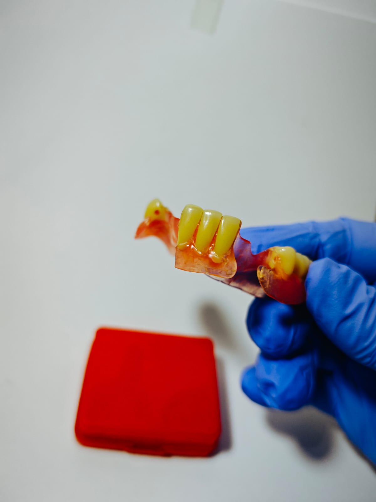 Contoh hasil gigi palsu Valplast Viqrie Dental Bogor