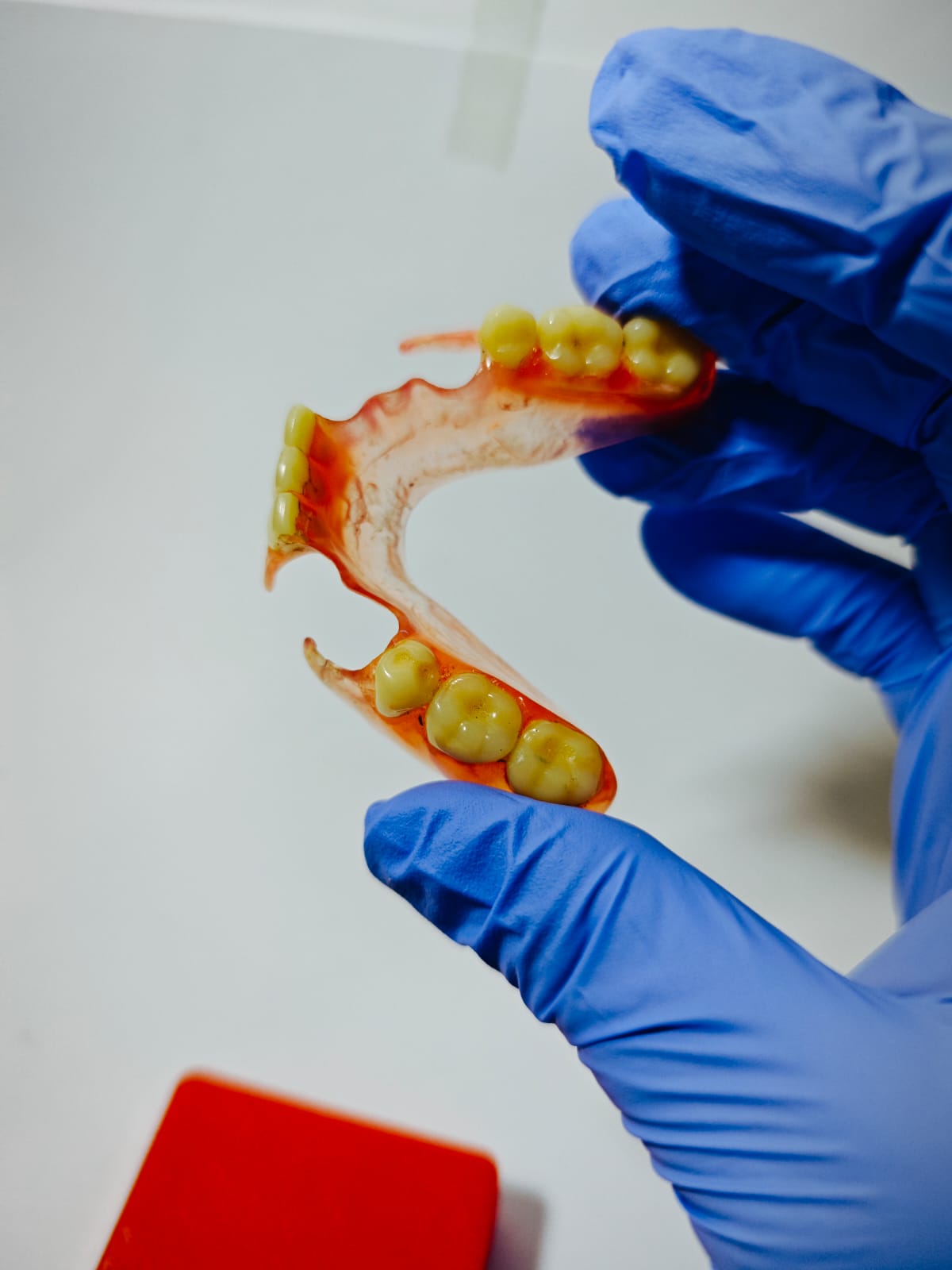 Gigi palsu Valplast fleksibel Bogor hasil Viqrie Dental 3