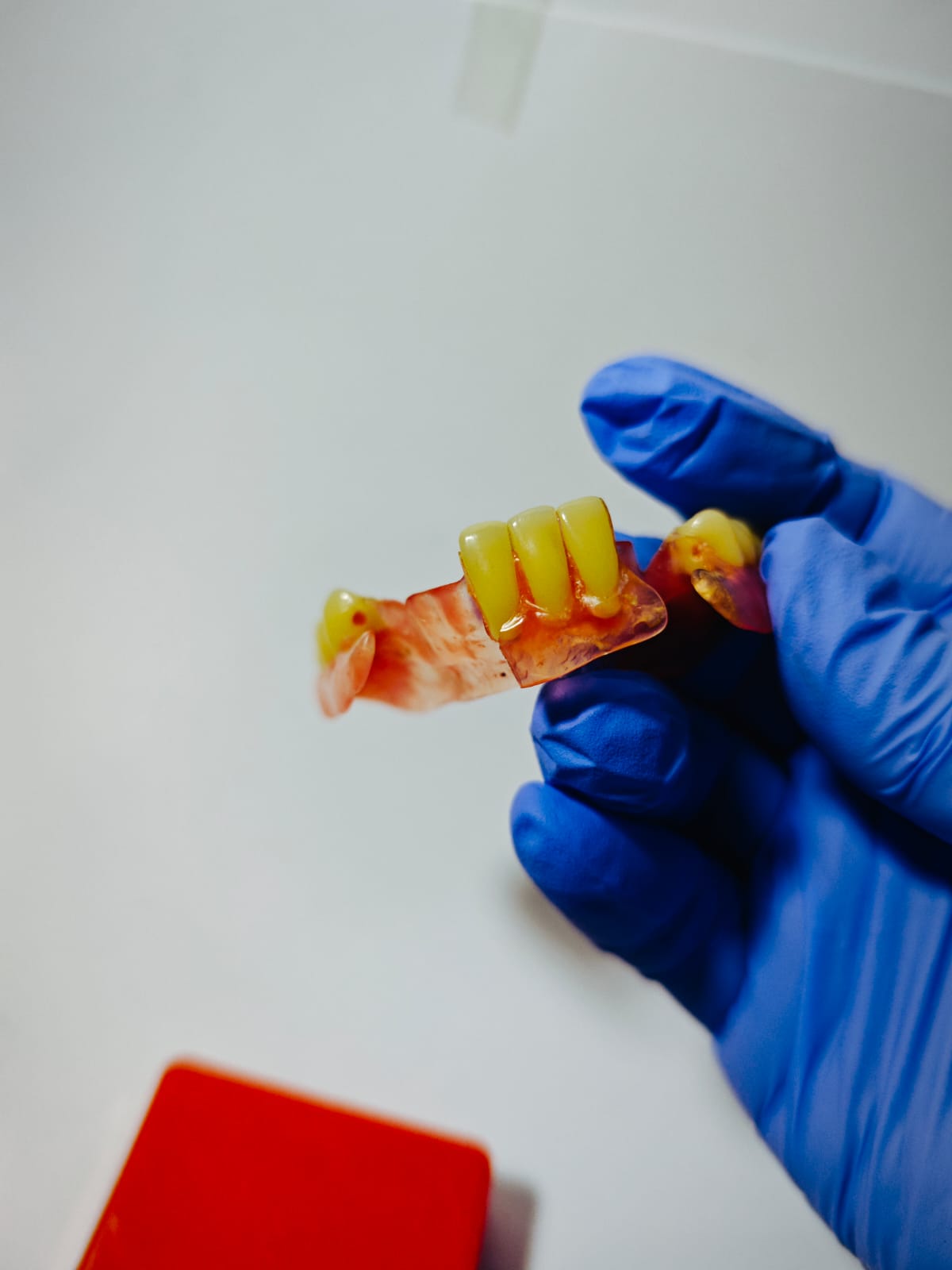 Contoh hasil gigi palsu Valplast Viqrie Dental Bogor 4