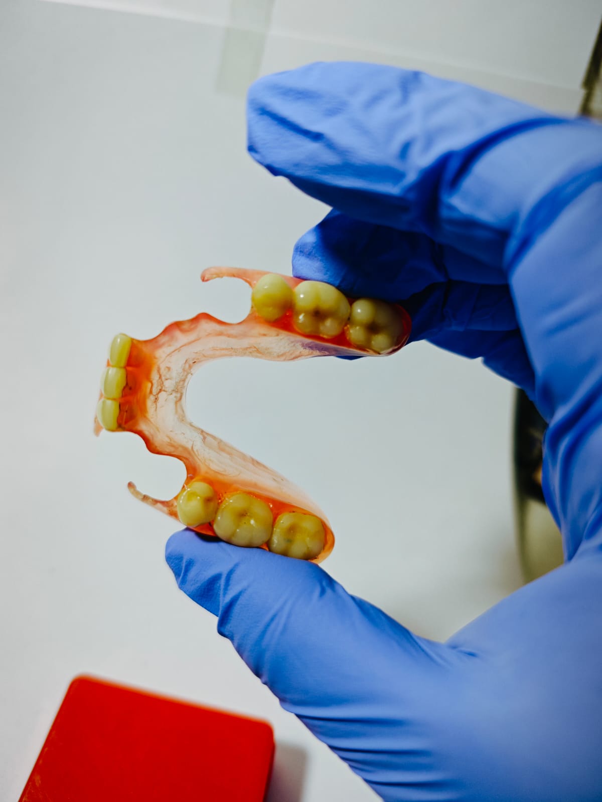 Pembuatan gigi palsu Valplast Bogor Viqrie Dental 5