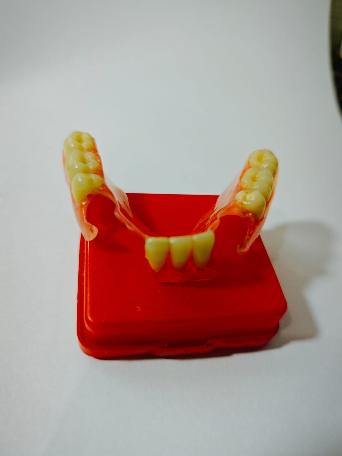 Dokumentasi hasil gigi palsu Valplast Viqrie Dental 7